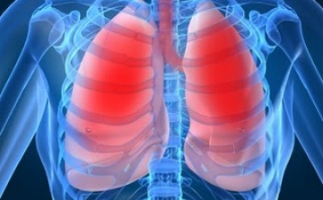 Minden tizedik ember halálát tüdőbetegség okozza